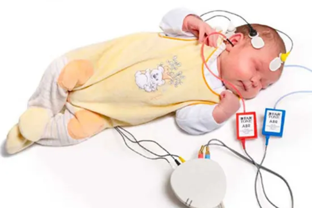 Brain Evoked Response Audiometry (BERA) Test